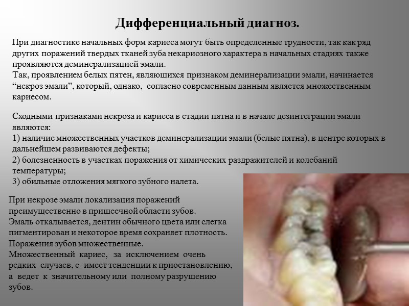 Дифференциальный диагноз.  При диагностике начальных форм кариеса могут быть определенные трудности, так как